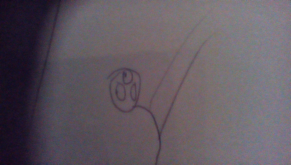 A simple weird random death cause