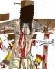 Go to 'Crucified' comic