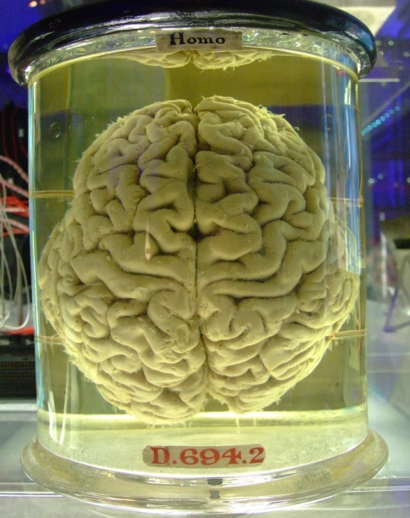 Brain in a Vat