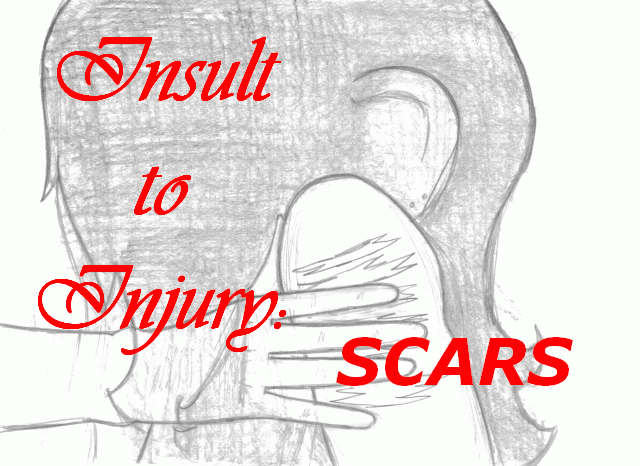 SCARS